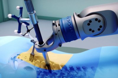 The impact of COVID-19 on Orthopedic Surgical Robots Market: 2020 Global Industry Trends, Growth, Share, Size and 2025 Forecast Research Report