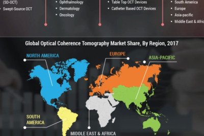 Optical Coherence Tomography Market Analysis, size, trends, top leaders, demand industry growth and forecast till 2027
