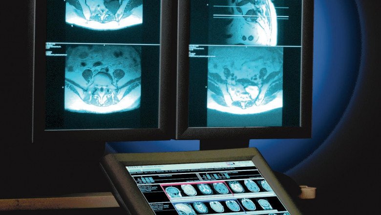 Picture Archiving and Communication System (PACS) Market: Global Industry Trends, Share, Size, Growth, Opportunity and Forecast 2026
