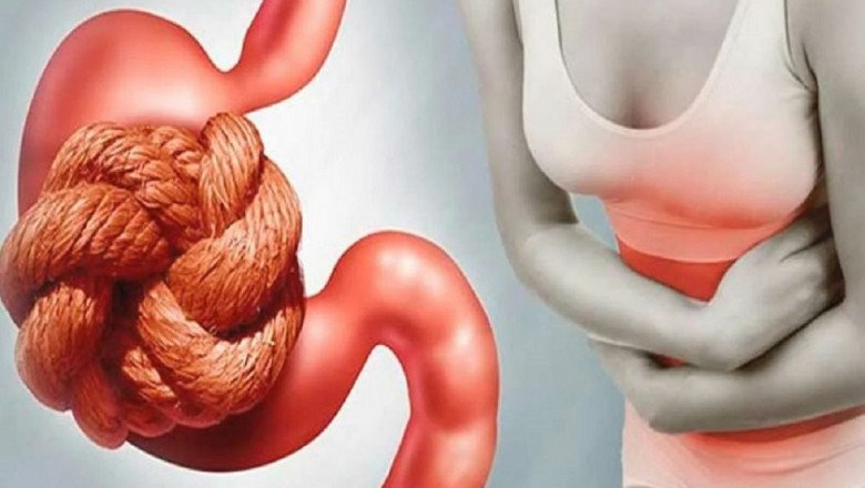 Constipation Treatment Begins With Lifestyle Changes And Diet Changes To Speed Up Stool Transit