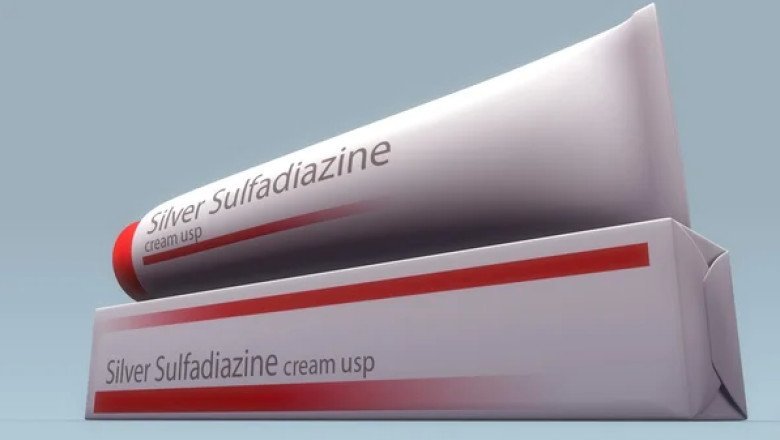 Burns Of A Second- And Third-Degree Are Treated And Prevented With Silver Sulfadiazine