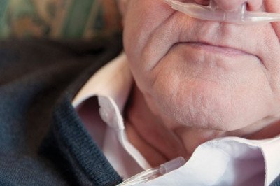 In Order To Treat Patients Or People In Need Of Respiratory Help, Nasal Cannulas (NC) Provide Additional Oxygen Or Increased Airflow