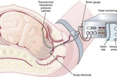 Advancements in Technology in Fetal and Neonatal Monitoring Market
