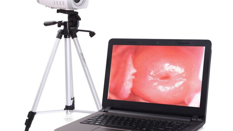 Medical Devices Such As Colposcope Are Used To Examine The Cervix, Vagina, And Vulva In Detail