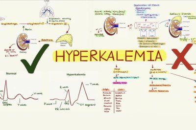 Hyperkalemia Treatment Market Insights, Analysis