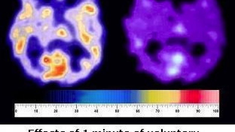 how to get rid of a cough