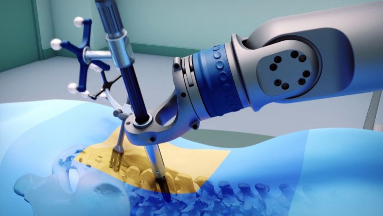 The impact of COVID-19 on Orthopedic Surgical Robots Market: 2020 Global Industry Trends, Growth, Share, Size and 2025 Forecast Research Report
