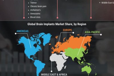 Brain Implants Market Size, Outlook by Geographical Segmentation &amp; Share, Comprehensive Analysis to 2030