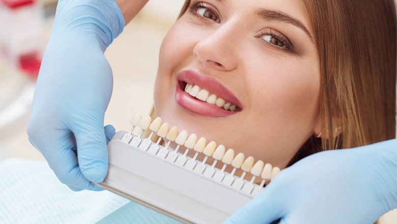What Are The Benefits Of Teeth Whitening? - Tower House Dental Clinic
