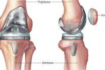 WHAT IS THE DIFFERENCE BETWEEN TRAUMATOLOGY AND CHILDREN'S ORTHOPEDICS?