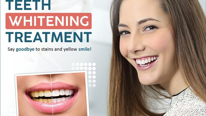 Zoom Teeth Whitening Benefits and Smile Designing in Gurgaon