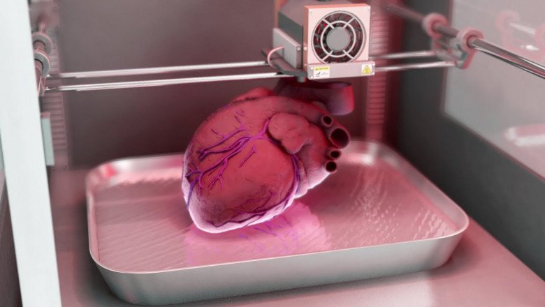 3D Printed Medical Devices are now widely used in the field of implants.