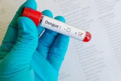 An outbreak of dengue vaccine is caused by a virus spread by mosquitoes, which can cause an illness similar to that of the flu.
