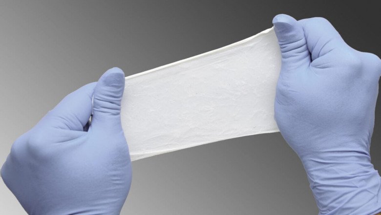 The Global Soft Tissue Repair Market: Share, Size, Growth, Opportunity, and Forecasts