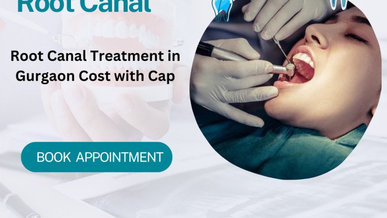 Root Canal Treatment Cost With Cap