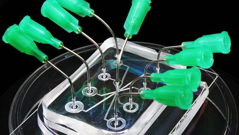 Regional Analysis of Microfluidics Market, Forecast Analysis 2019-2027