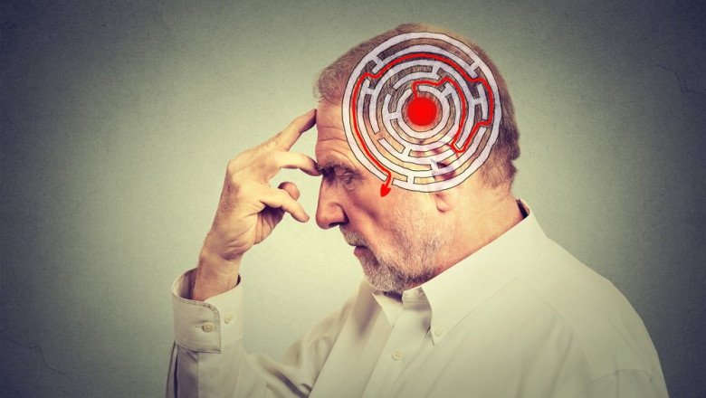 All you Need to Know about Stroke Management