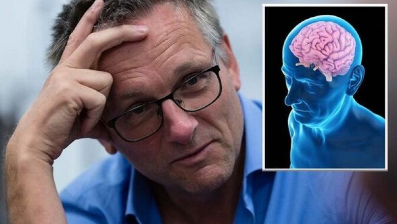Alzheimer’s Drugs Market Insights and Forecast Analysis during 2017-2025