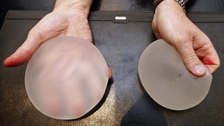 Forecasting 2019-2027: Global Asia Pacific Breast Implants Market trends, share, size, growth, opportunities, and forecasts