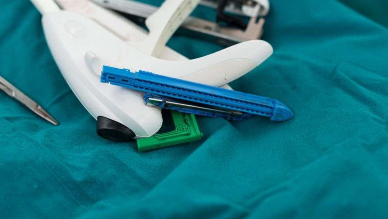 With Surgical Stapling Devices, The Stomach May Be Compartmentalized Without A Complete Transection