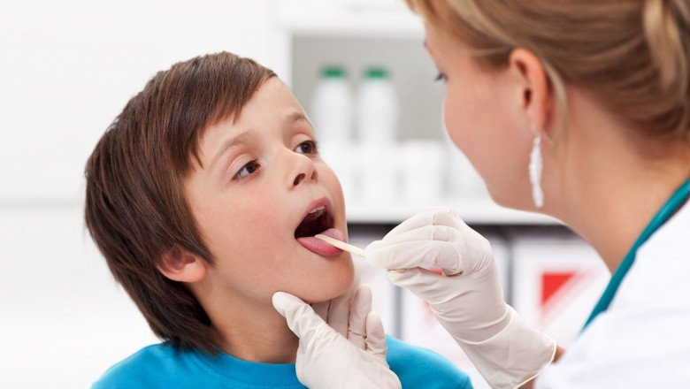 A study of the global Pharyngitis Therapeutics Market : trends, market size, growth, opportunity, as well as forecasts for 2022-2028
