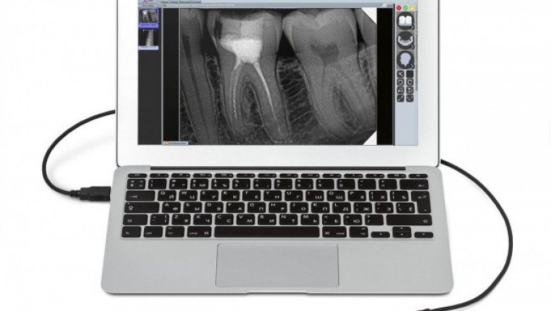 In X-Ray Detectors, Flux, Spatial Distribution, Spectrum, Or Other Values Are Measured