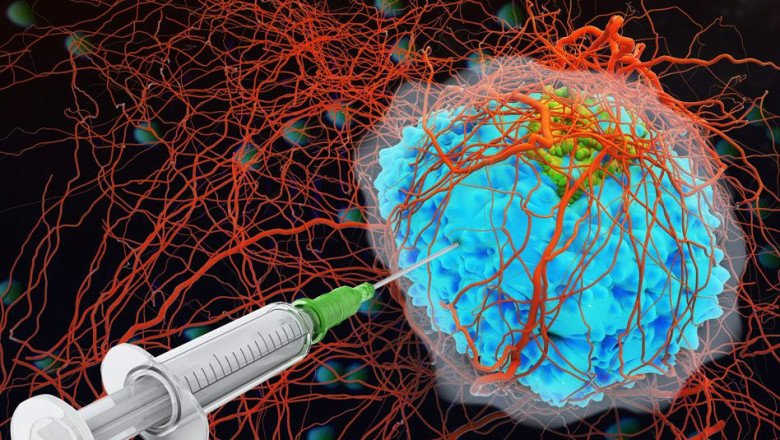 Cancer Therapy Market Global Growth Opportunities and Forecast 2028
