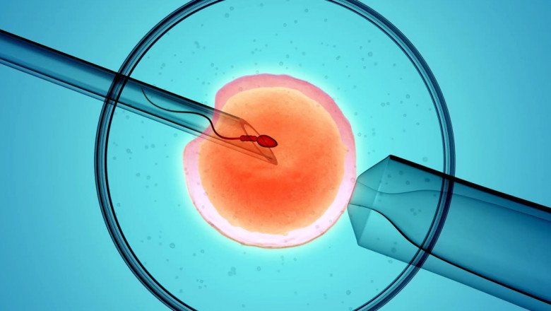 An Artificial Insemination Procedure Involves Collecting Living Sperm From A Male And Introducing It Into A Female Reproductive Tract With The Help Of An Instrument At The Proper Time