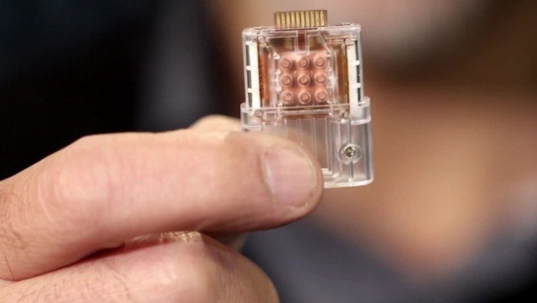 Based On Microfluidic And Microarray Technology, Biochips Are Developed