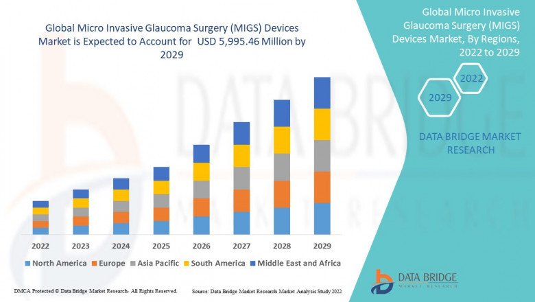 Market Future Scope and Growth Factors of Micro Invasive Glaucoma Surgery (MIGS) Devices Market up to 2029