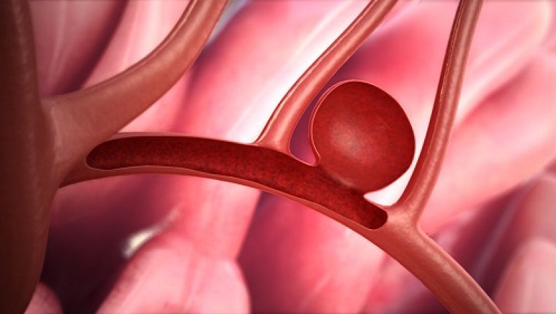 Global Transcatheter Embolization and Occlusion Devices Market : Trends, Size, Growth, Opportunity, and Forecast to 2022-2028