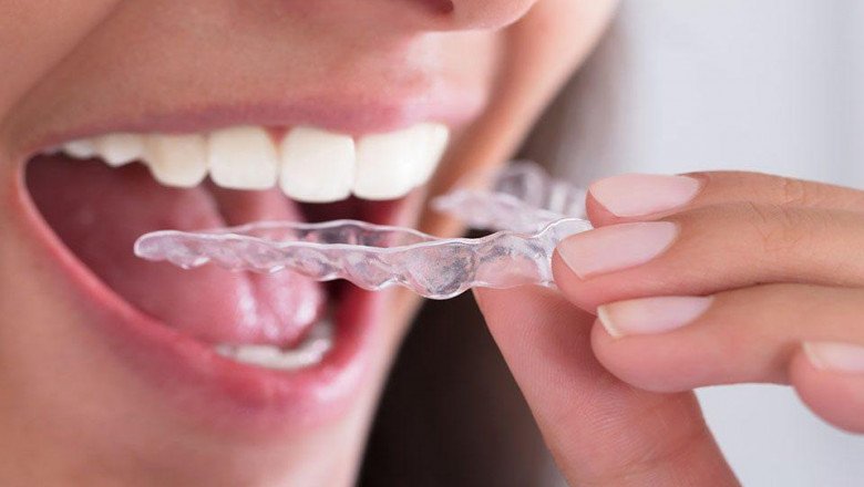 How can Bruxism Damage Childs Teeth? What is Bruxism Treatment?