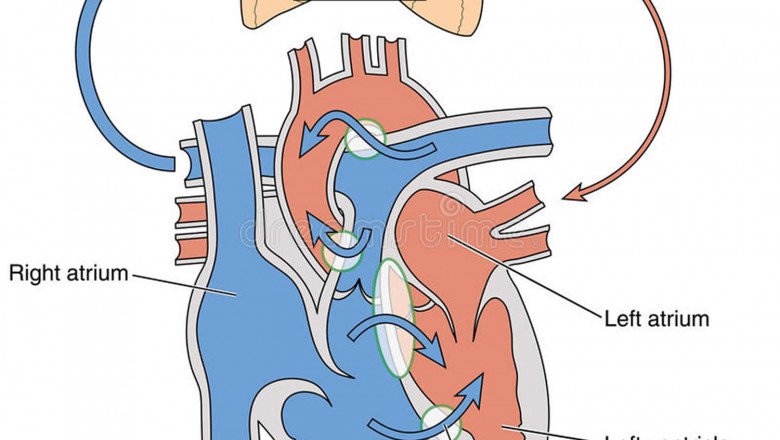 Patients With Eisenmengers Syndrome Will Require Eisenmenger Syndrome Treatment Depending On Their Symptoms And Condition