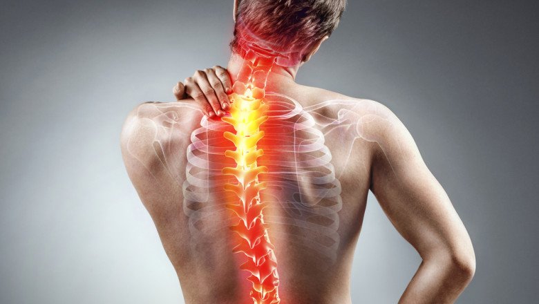 Helps Improve the Quality of Life for People with Scoliosis Management