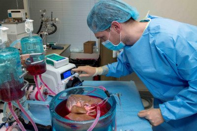 Factors Driving Growth for Global Transplant Diagnostics Market, Forecast Analysis 2017-2025