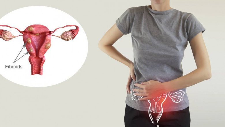 In endometriosis treatment, estrogen or progesterone levels are decreased