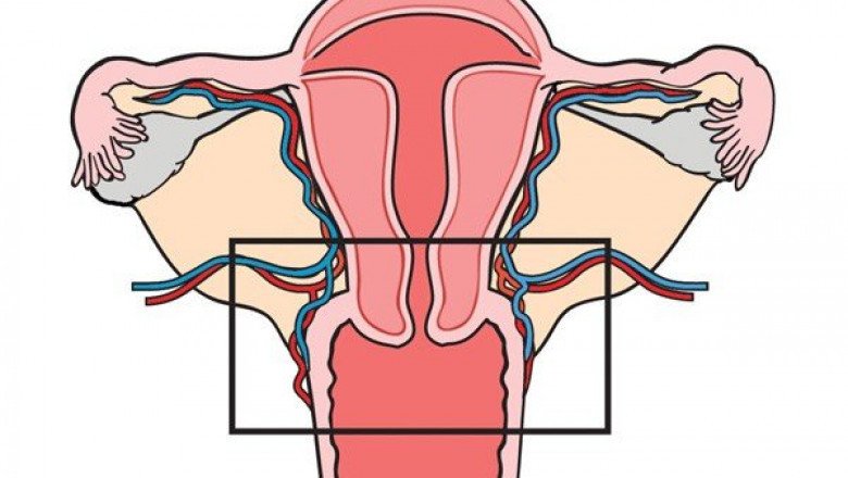 Global Cervical Dysplasia Market Business Plan Strategy, New Solutions, Key Segments, Potential Targets and Recommendations