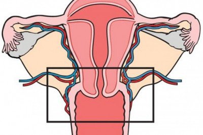 Global Cervical Dysplasia Market Business Plan Strategy, New Solutions, Key Segments, Potential Targets and Recommendations