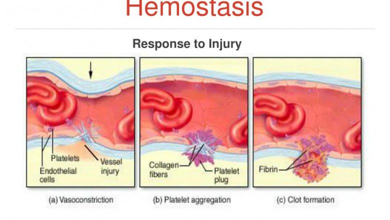 Patients who undergo Hemostasis Diagnostics tests have their blood drawn from an arm vein.