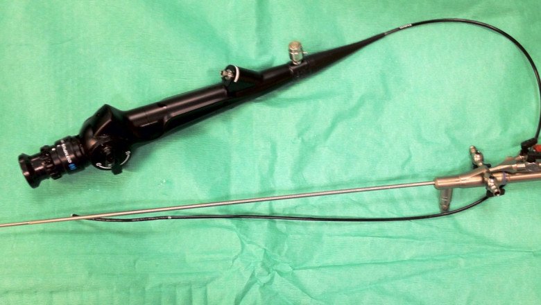 Using An Ureteroscope, You Can Find Calculi Inside The Uterus By Illuminating It With Light And Using A Camera To Take Pictures