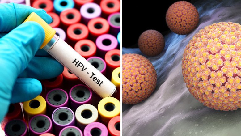 HPV and Pap Testing Reduce the Chances of People Developing Cancer Around the World