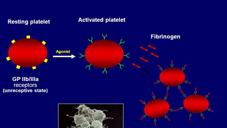 Platelet Aggregation Devices Are Used To Determine Platelet Capabilities