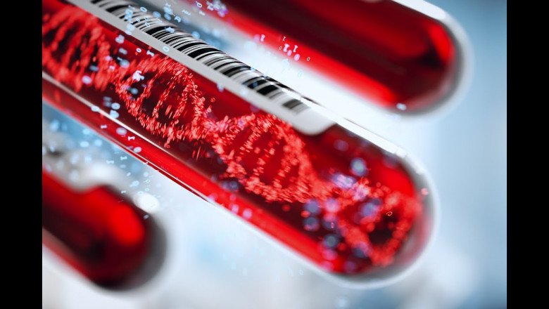 The Global Liquid Biopsy Market Is Estimated To Account For US$ 3,535.1 Mn In Terms Of Value By The End Of 2027