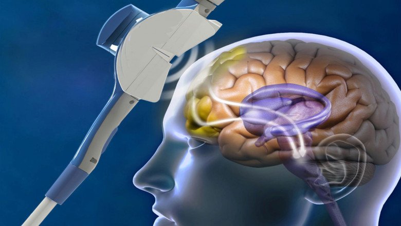 Wireless Visual Cortical Stimulator; used to restore functional vision to the blind