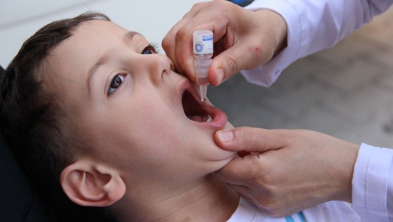 As A Result Of Polio Vaccine Development, There Has Been A Dramatic Reduction In The Number Of Cases And The Spread Of Polio