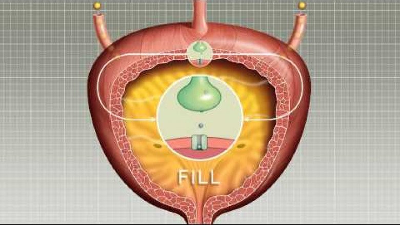 Overactive Bladder Therapeutics Market : Global Industry Trends, Share, Size, Growth, Opportunity and Forecast 2022-2028