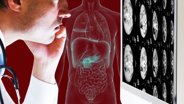 Pancreatic Cancer Therapeutics and Diagnostic Market : Global Industry Trends, Share, Size, Growth, Opportunity and Forecast 2022-2028