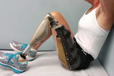 Prosthetic Legs Can Make It Easier For People With Amputations To Move Around