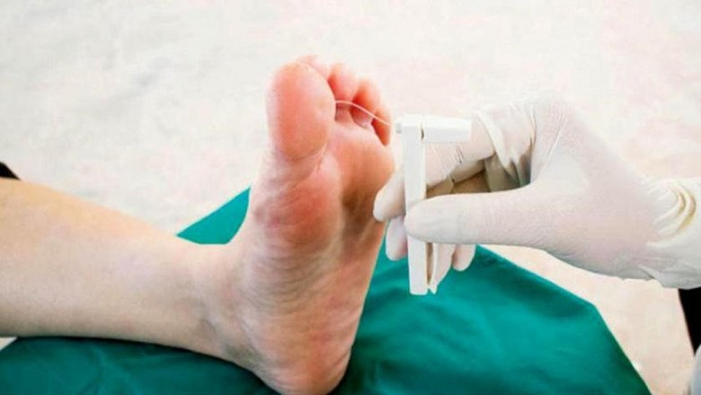 What are the microvascular Diseases In Diabetic Neuropathy?