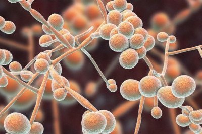 Candidiasis Market Outlook and Overview during the Forecast Period 2018-2026